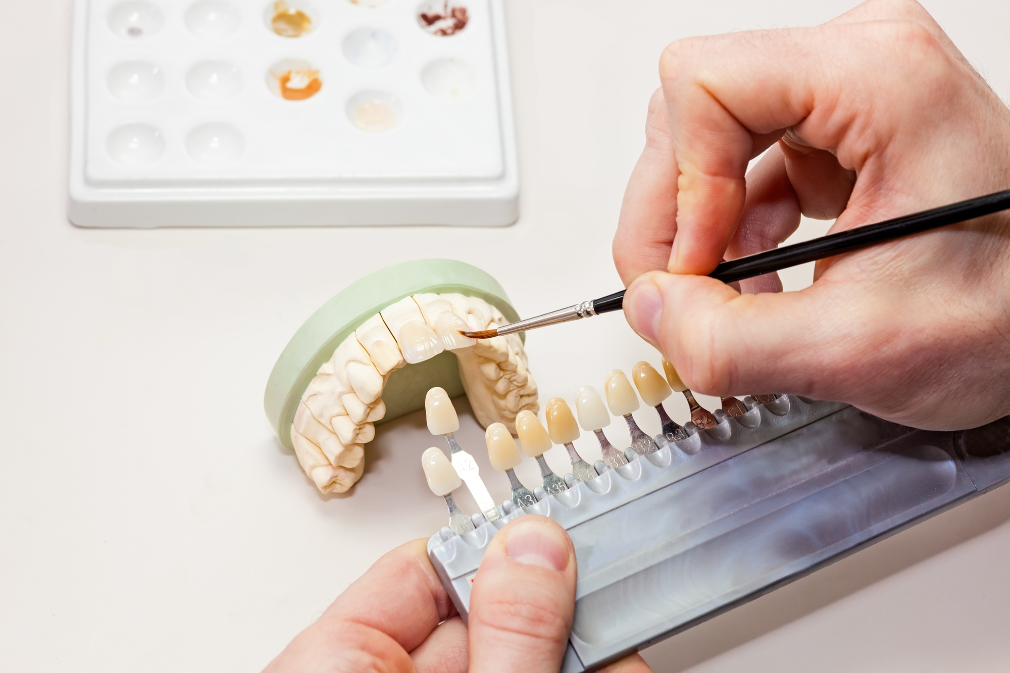What Is An Aesthetic Dentist And How They Can Help You Estrabillo